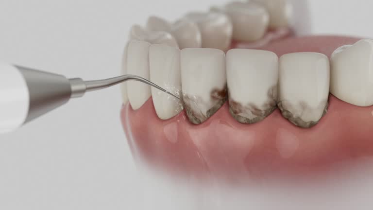 Reliable Dental Implants contractor in Marshall, WI by Smile Center Dentistry